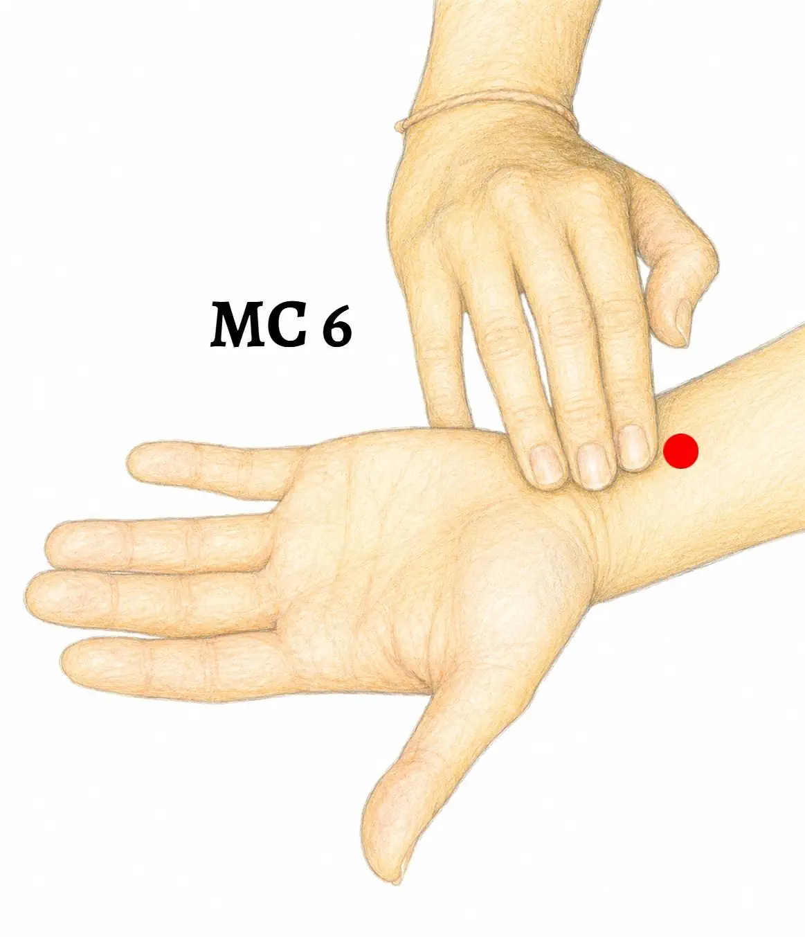 MC6
