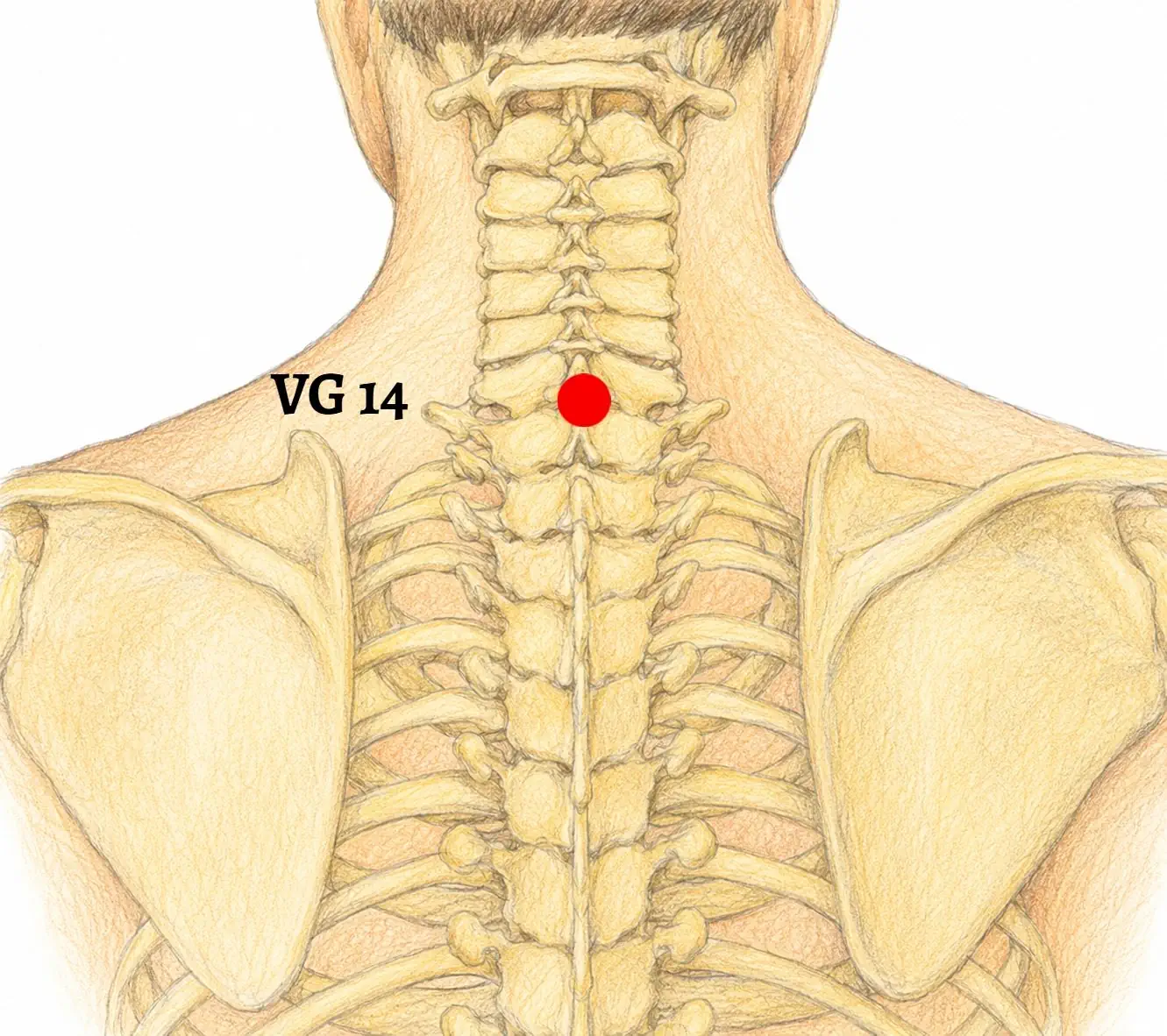 VG 14