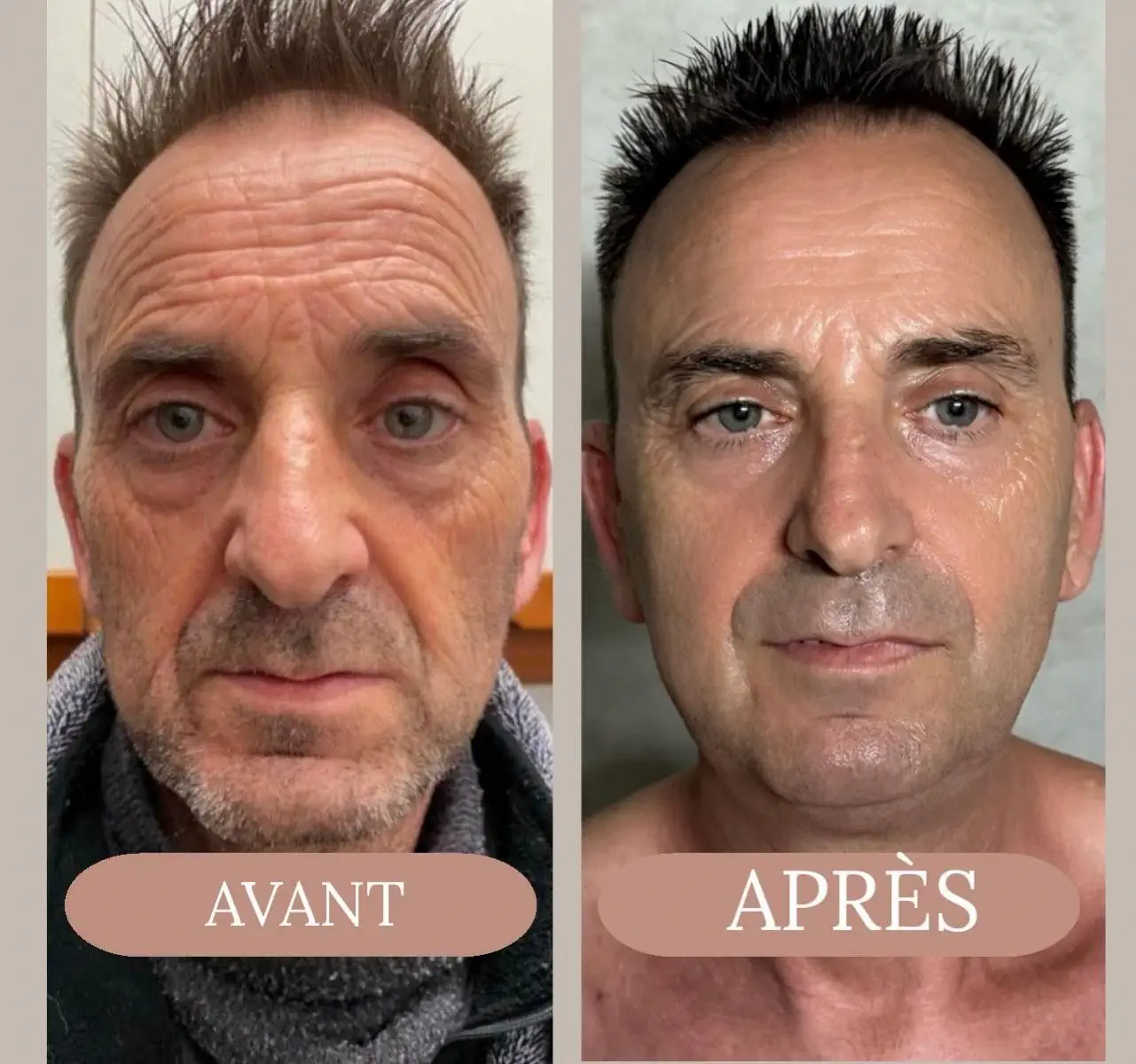 Avant après Javier