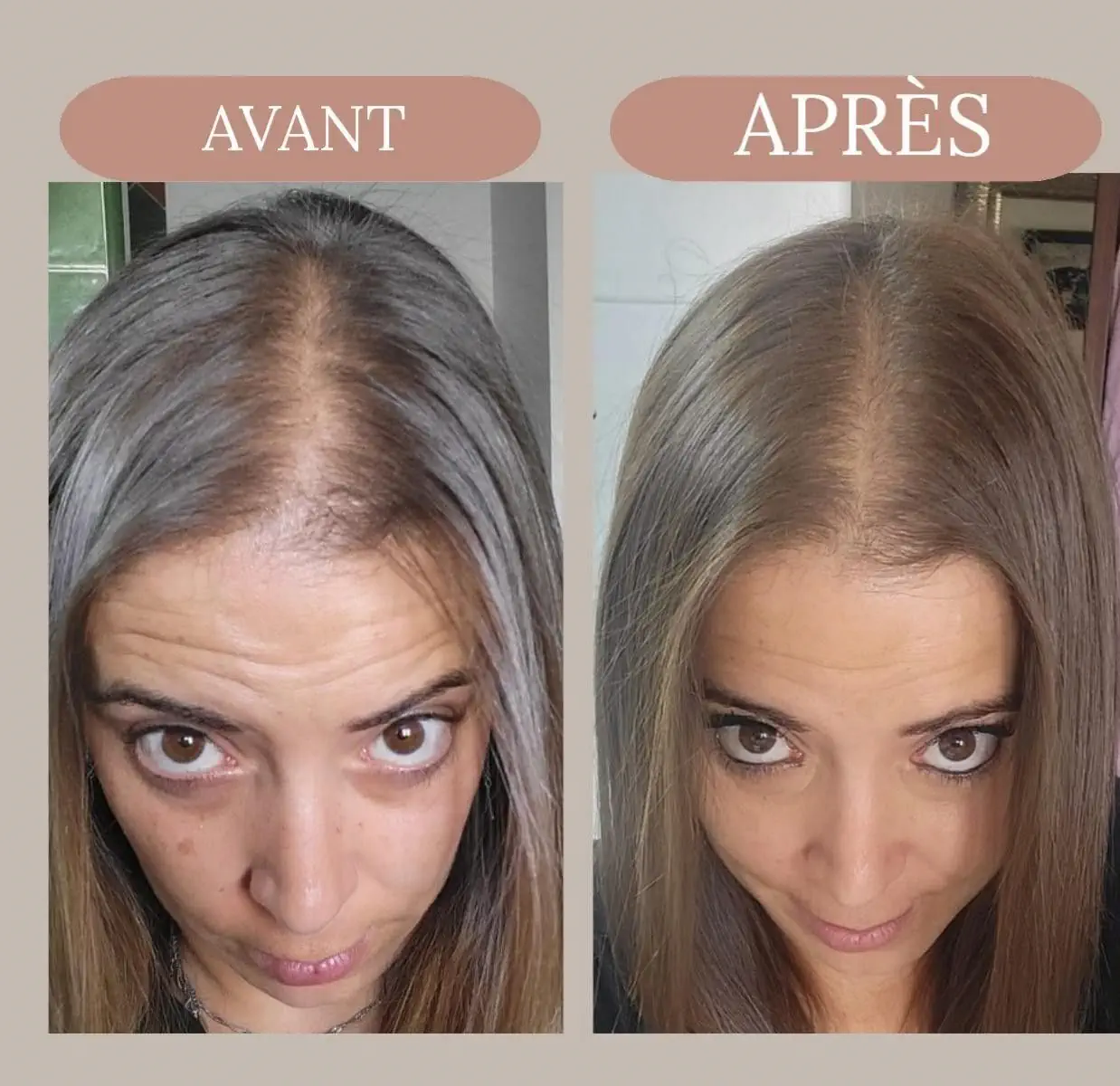 Avant après Sherezhade