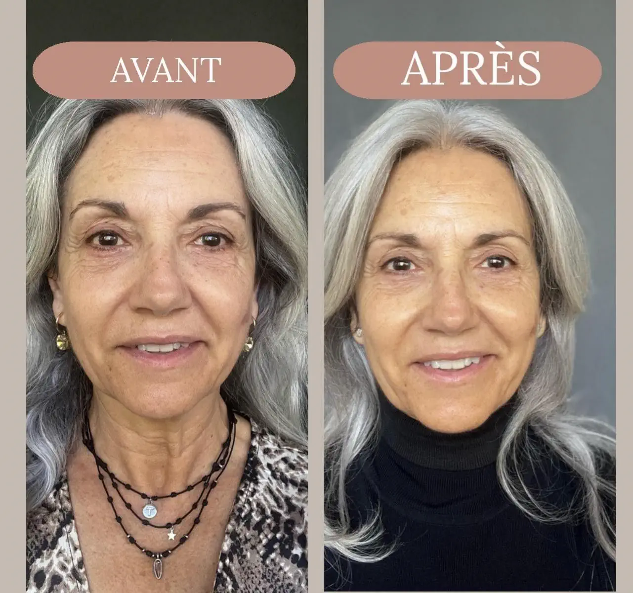 Avant après Toni
